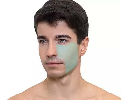 Лазерная эпиляция лица для мужчин: эффективное и безопасное решение