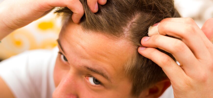 Комплексный терапевтический подход в лечении диффузного выпадения волос, современные методы и результаты