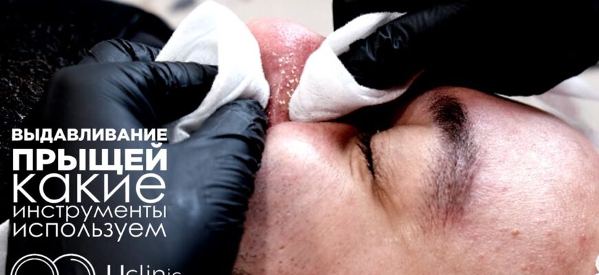 Мезотерапия для волос в Волгограде в клинике косметологии "Uclinic"