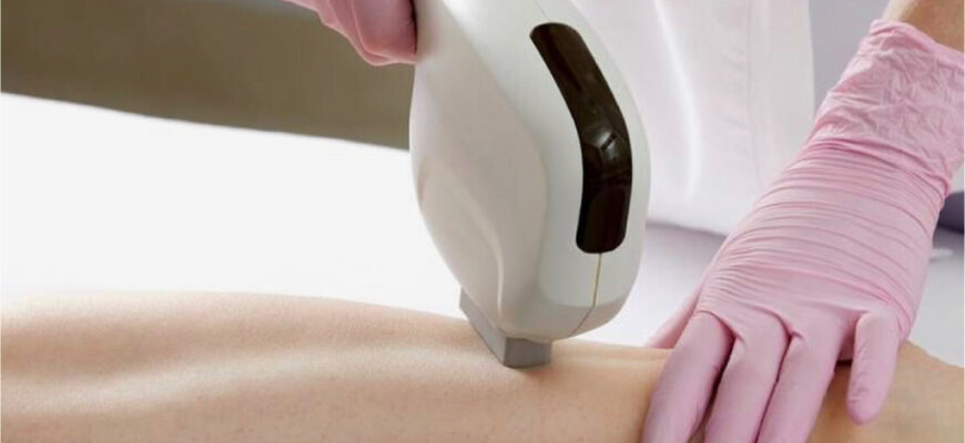 Лазерная эпиляция по выгодной цене в сети центров ProLaser - скидка 30%