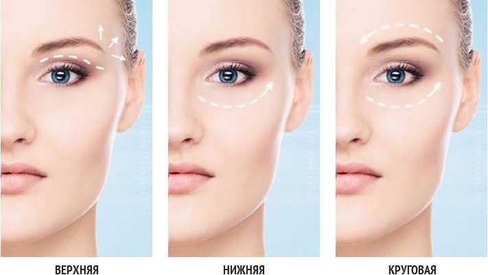 Что такое Блефаропластика и её суть