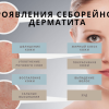Основы себорейного дерматита и его симптомы